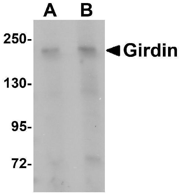 Western blot analysis of Girdin in rat brain tissue lysate with Girdin antibody at (A) 1 and (B) 2 μg/mL