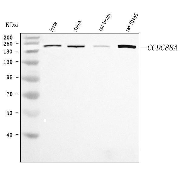  Western blot analysis of CCDC88A using anti-CCDC88A antibody (A03282-3)