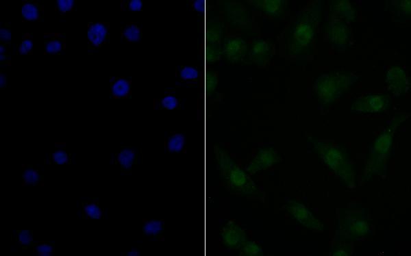 ICC staining Nucleostemin in A549 cells (green)