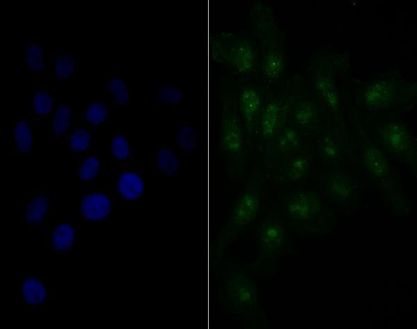 ICC staining Nucleostemin in HepG2 cells (green)