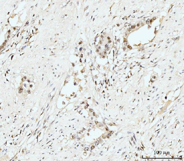 IHC analysis of Nucleostemin/GNL3 using anti-Nucleostemin/GNL3 antibody (A03283-3)
