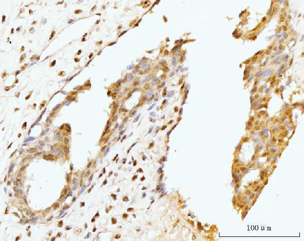  IHC analysis of Nucleostemin/GNL3 using anti-Nucleostemin/GNL3 antibody (A03283-3)