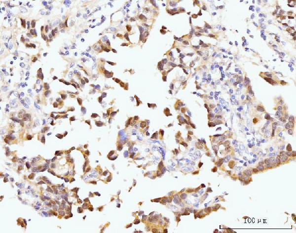 a03283 3 gnl3 primary antibodies ihc testing 4