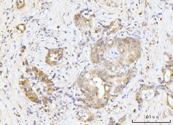 a03283 3 gnl3 primary antibodies ihc testing 5