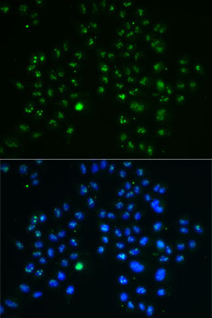 Immunofluorescence analysis of MCF7 cells using GNL3 antibody 