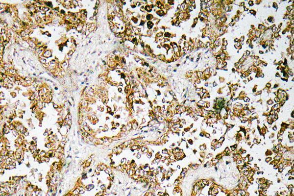 a03284 gata5 primary antibodies ihc testing 1