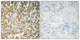 a03284 gata5 primary antibodies ihc testing 2