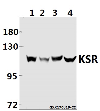 Western blot (WB) analysis of KSR (R386) pAb at 1:500 dilution
Lane1:SGC7901 whole cell lysate(40ug)
Lane2:Hela whole cell lysate(40ug)
Lane3:BV2 whole cell lysate(40ug)
Lane4:C6 whole cell lysate(40ug)