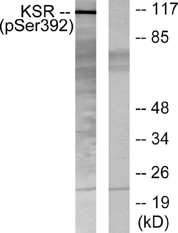 Western blot analysis of lysates from HepG2 cells, using KSR (Phospho-Ser392) Antibody