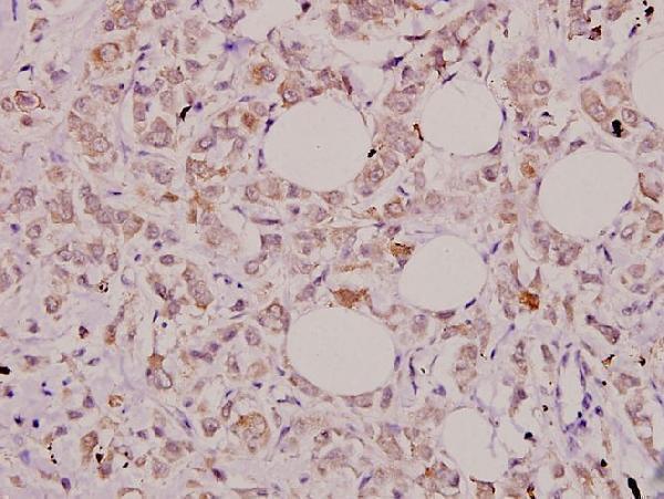 a03286 3 il32 primary antiboties ihc testing 2