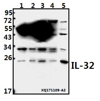 a03286 3 il32 primary antiboties wb testing 1