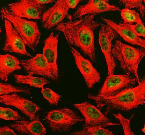 IF analysis of PHF8 using anti-PHF8 antibody (A03288-2) and anti-Beta Tubulin antibody (M01857-3)