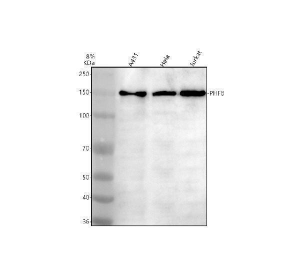Western blot analysis of PHF8 using anti-PHF8 antibody (A03288-2)