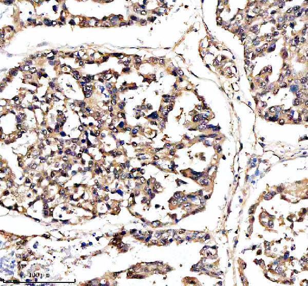  IHC analysis of DNAJB6 using anti-DNAJB6 antibody (A03290-1)