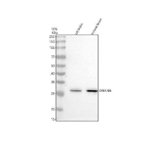  Western blot analysis of DNAJB6 using anti-DNAJB6 antibody (A03290-1)