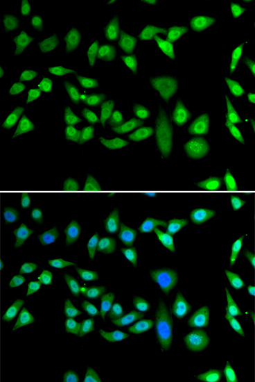 Immunofluorescence analysis of U2OS cells using DNAJB6 antibody 
