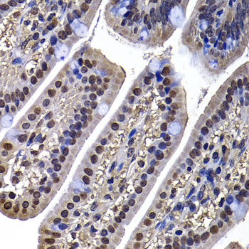 a03290 dnajb6 primary antiboties ihc testing 3