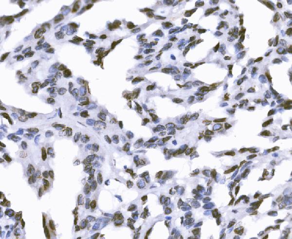  IHC analysis of SUN2 using anti-SUN2 antibody (A03291-1)