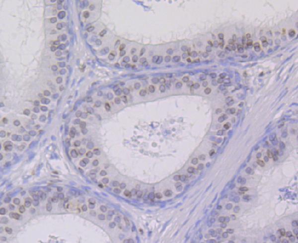a03291 sun2 primary antiboties ihc testing 2