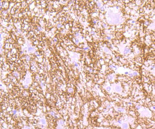 a03294 1 mog primary antiboties ihc testing 1