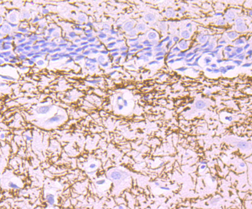 a03294 1 mog primary antiboties ihc testing 2