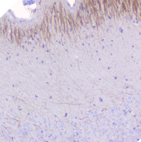 IHC analysis of Myelin oligodendrocyte glycoprotein using anti-Myelin oligodendrocyte glycoprotein antibody (A03294). Myelin oligodendrocyte glycoprotein was detected in paraffin-embedded section of mouse brain tissues. Heat mediated antigen retrieval was performed in citrate buffer (pH6, epitope retrieval solution) for 20 mins. The tissue section was blocked with 10% goat serum. The tissue section was then incubated with 1μg/ml rabbit anti-Myelin oligodendrocyte glycoprotein Antibody (A03294) overnight at 4°C. Biotinylated goat anti-rabbit IgG was used as secondary antibody and incubated for 30 minutes at 37°C. The tissue section was developed using Strepavidin-Biotin-Complex (SABC)(Catalog # SA1022) with DAB as the chromogen.