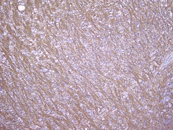 IHC analysis of Myelin oligodendrocyte glycoprotein using anti-Myelin oligodendrocyte glycoprotein antibody (A03294). Myelin oligodendrocyte glycoprotein was detected in paraffin-embedded section of rat brain tissues. Heat mediated antigen retrieval was performed in citrate buffer (pH6, epitope retrieval solution) for 20 mins. The tissue section was blocked with 10% goat serum. The tissue section was then incubated with 1μg/ml rabbit anti-Myelin oligodendrocyte glycoprotein Antibody (A03294) overnight at 4°C. Biotinylated goat anti-rabbit IgG was used as secondary antibody and incubated for 30 minutes at 37°C. The tissue section was developed using Strepavidin-Biotin-Complex (SABC)(Catalog # SA1022) with DAB as the chromogen.