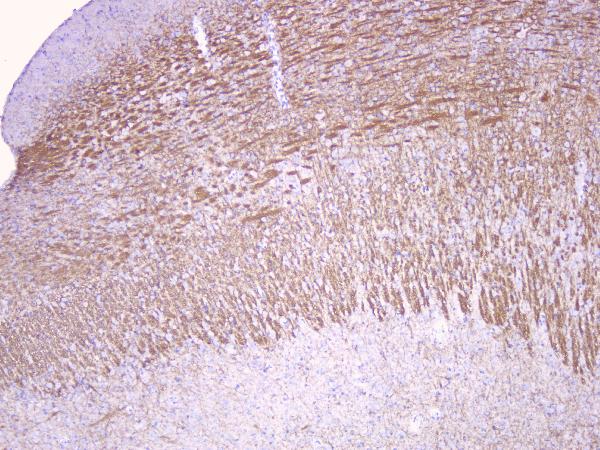 IHC analysis of Myelin oligodendrocyte glycoprotein using anti-Myelin oligodendrocyte glycoprotein antibody (A03294). Myelin oligodendrocyte glycoprotein was detected in paraffin-embedded section of rat brain tissues. Heat mediated antigen retrieval was performed in citrate buffer (pH6, epitope retrieval solution) for 20 mins. The tissue section was blocked with 10% goat serum. The tissue section was then incubated with 1μg/ml rabbit anti-Myelin oligodendrocyte glycoprotein Antibody (A03294) overnight at 4°C. Biotinylated goat anti-rabbit IgG was used as secondary antibody and incubated for 30 minutes at 37°C. The tissue section was developed using Strepavidin-Biotin-Complex (SABC)(Catalog # SA1022) with DAB as the chromogen.