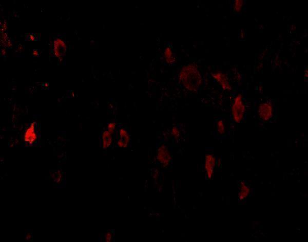 a03295 pdcd1lg2 primary antibodies if testing 6