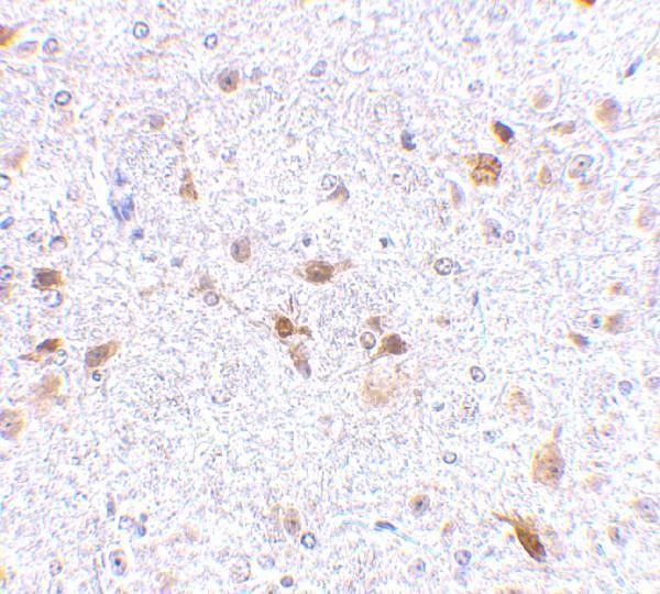 a03295 pdcd1lg2 primary antibodies ihc testing 5