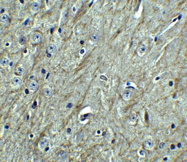 a03295 pdcd1lg2 primary antibodies ihc testing 7
