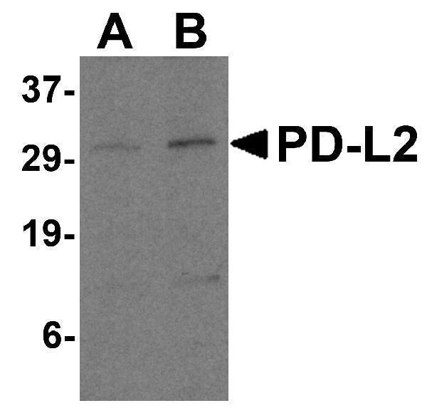 Western Blot Validation in Human Raji Cell Lysate
Loading: 15 μg of lysates per lane