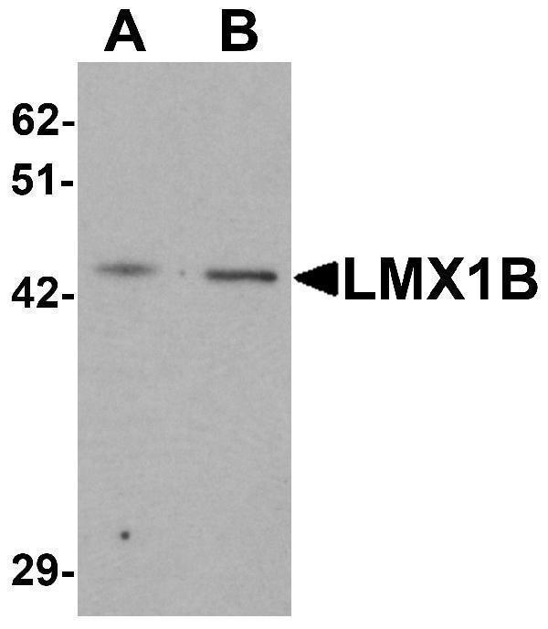 Western blot analysis of LMX1B in A-20 cell lysate with LMX1B antibody at (A) 1 and (B) 2 μg/mL