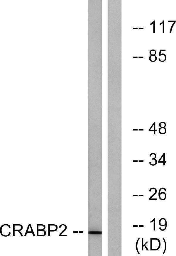 Western blot analysis of lysates from HT-29 cells, using CRABP2 Antibody
