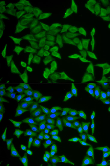 Immunofluorescence analysis of U2OS cells using CRABP2 antibody 