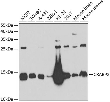 Western blot analysis of extracts of various cell lines, using CRABP2 antibody  at 1:1000 dilution