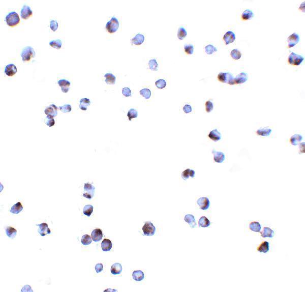 a03300 1 dapk3 primary antibodies icc testing 3
