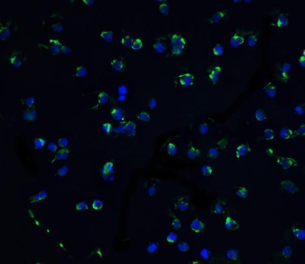 a03300 1 dapk3 primary antibodies if testing 2