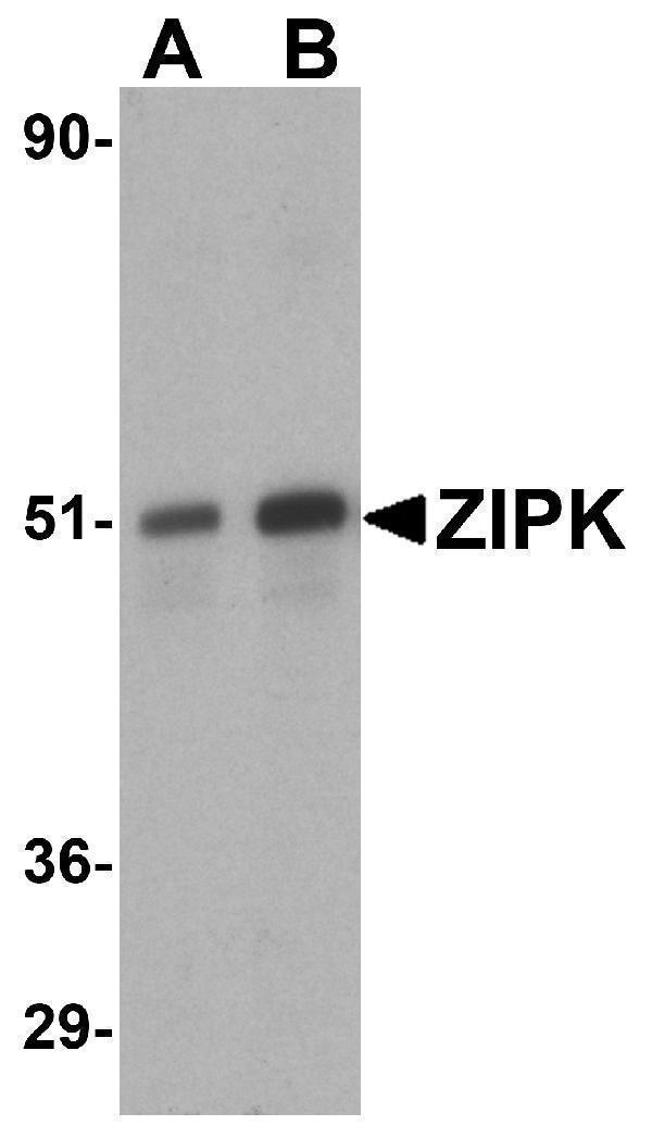 a03300 1 dapk3 primary antibodies wb testing 1