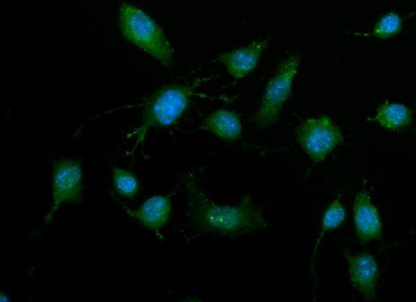  IF analysis of ZIP Kinase/Dapk3 using anti-ZIP Kinase/Dapk3 antibody (A03300-3)