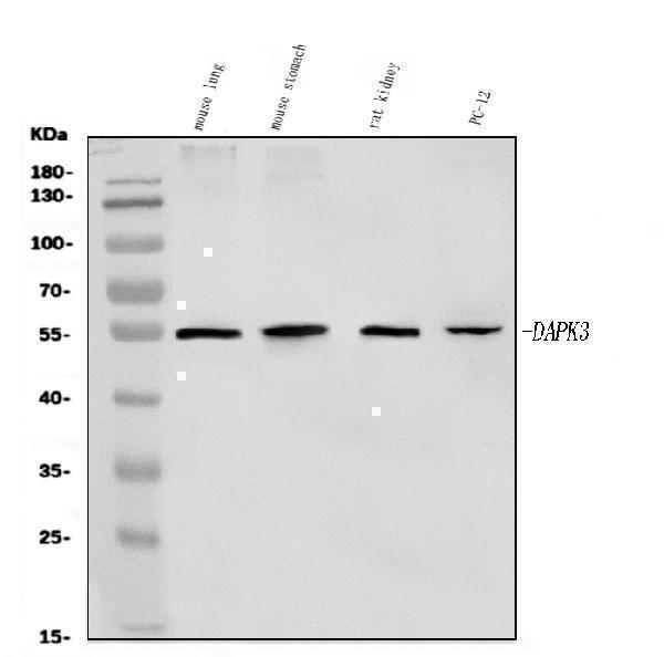  Western blot analysis of ZIP Kinase/Dapk3 using anti-ZIP Kinase/Dapk3 antibody (A03300-3)