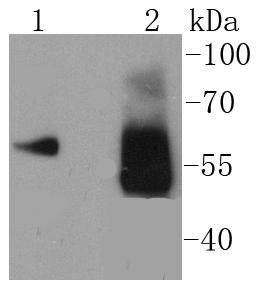 a03302 1 asns primary antiboties wb testing 1