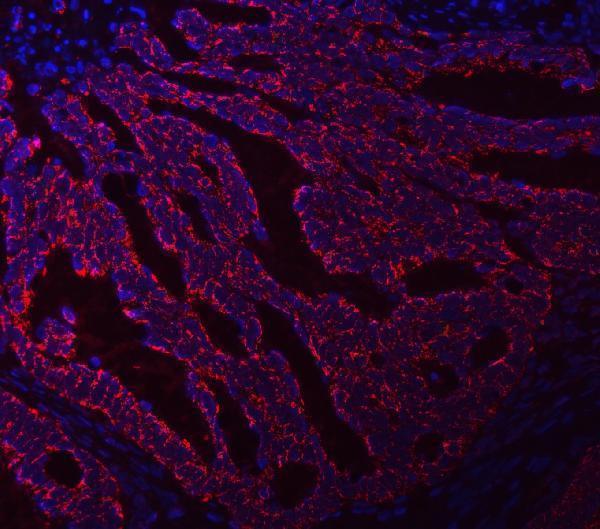 a03302 2 asns primary antibodies if testing 5
