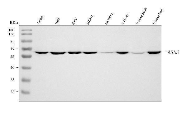  Western blot analysis of Asparagine synthetase/ASNS using anti-Asparagine synthetase/ASNS antibody (A03302-2)