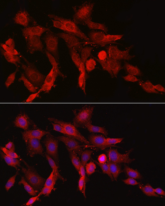 a03302 asns primary antiboties if testing 4