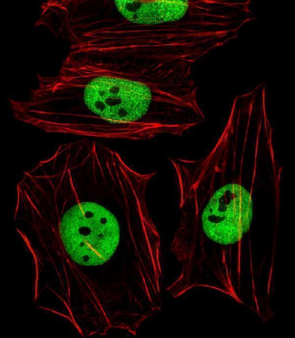 a03303 2 anti mouse smarcc1 antibody c term if testing 1