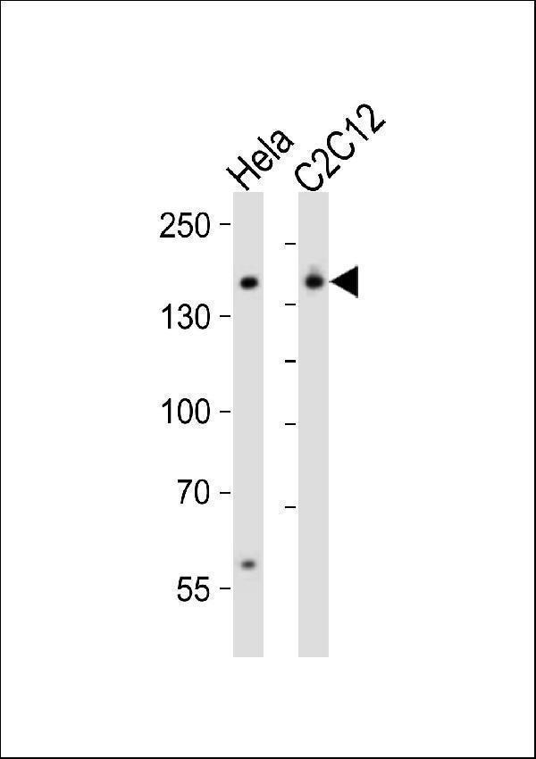 a03303 2 anti mouse smarcc1 antibody c term wb testing 2