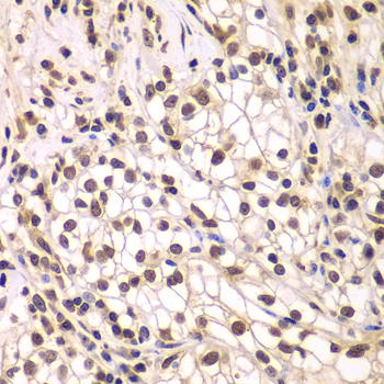 a03303 smarcc1 primary antiboties ihc testing 4