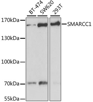 a03303 smarcc1 primary antiboties wb testing 1