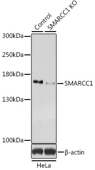 a03303 smarcc1 primary antiboties wb testing 2
